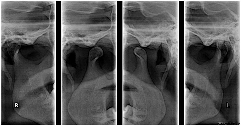 Detalle de A.T.M. Lateral