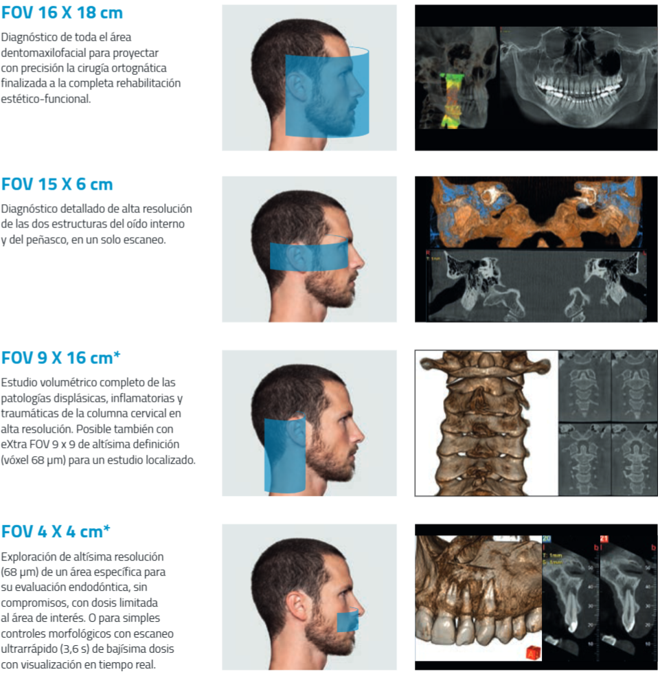 Aplicaciones 3D TAC Digital